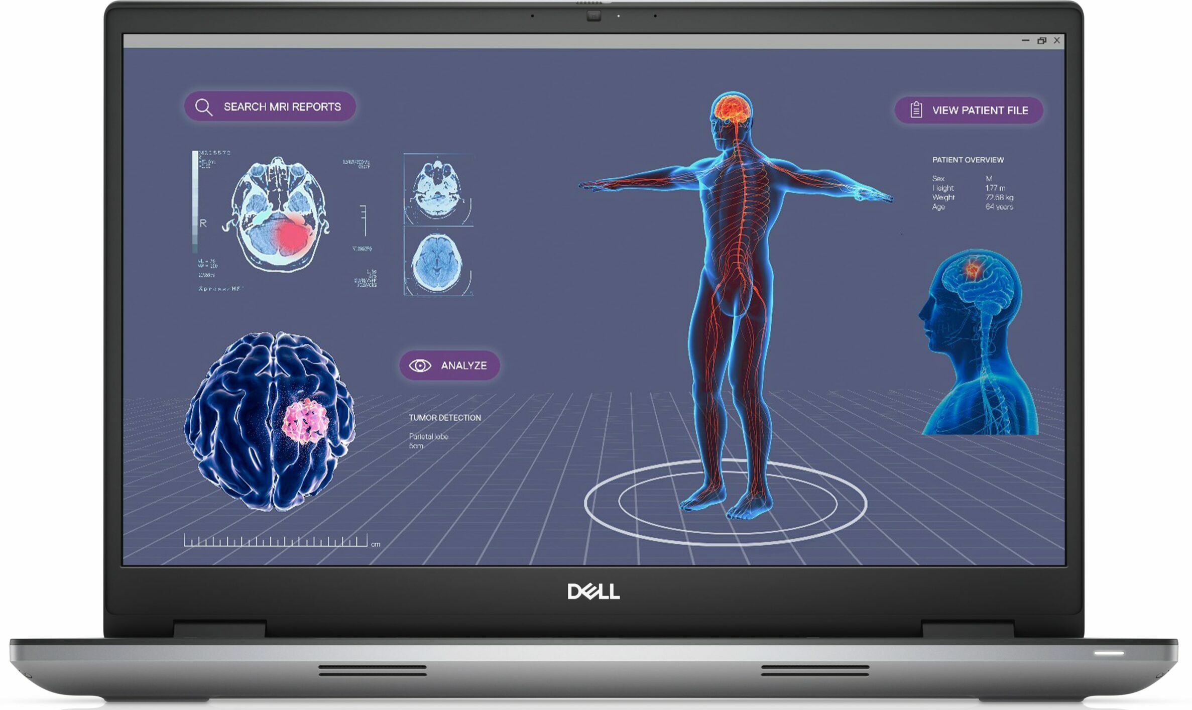Dell Precision 17 7780